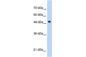 PNPLA3 antibody used at 1 ug/ml to detect target protein. (PNPLA3 antibody  (C-Term))