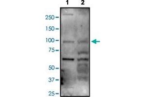 Western blot analysis of Lane 1: A549 and Lane 2: MCF-7 cell lysates with ARHGAP12 polyclonal antibody .