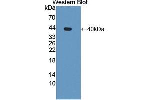 Detection of Recombinant MTHFR, Human using Polyclonal Antibody to Methylenetetrahydrofolate Reductase (MTHFR) (MTHFR antibody  (AA 1-325))