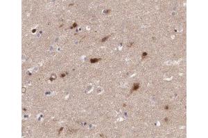 ABIN6266568 at 1/200 staining human brain tissue sections by IHC-P.