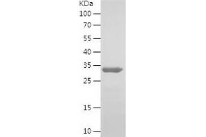 HDGF Protein (AA 1-240) (His tag)