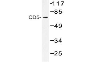 Figure 1. (CD5 antibody)