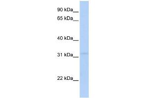 WB Suggested Anti-MTCH2 Antibody Titration: 0.