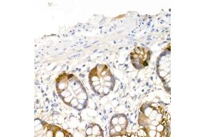 Immunohistochemistry of paraffin-embedded human small intestine using DDC Rabbit pAb (ABIN1679510, ABIN3018150, ABIN3018151 and ABIN6220384) at dilution of 1:25 (40x lens). (DDC antibody  (AA 1-100))