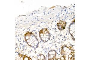 Immunohistochemistry of paraffin-embedded human small intestine using DDC Rabbit pAb (ABIN1679510, ABIN3018150, ABIN3018151 and ABIN6220384) at dilution of 1:25 (40x lens). (DDC antibody  (AA 1-100))