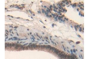 Immunohistochemistry (IHC) image for anti-Interleukin 17 Receptor D (IL17RD) (AA 356-605) antibody (ABIN7443272)