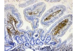 IHC testing of FFPE mouse intestine tissue with LYN antibody at 1ug/ml. (LYN antibody  (AA 470-501))