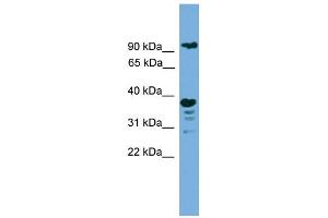WB Suggested Anti-LAMP1 Antibody Titration: 0. (LAMP1 antibody  (N-Term))