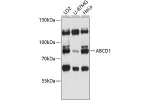 Western blot analysis of extracts of various cell lines, using  antibody (ABIN6129183, ABIN6136369, ABIN6136370 and ABIN6215725) at 1:3000 dilution. (ABCD1 antibody  (AA 340-500))