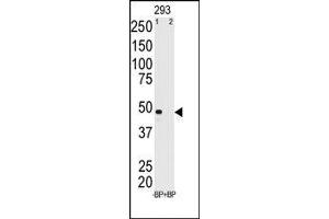 Image no. 2 for anti-Melanoma Antigen Family A, 11 (MAGEA11) (N-Term) antibody (ABIN358642) (MAGEA11 antibody  (N-Term))