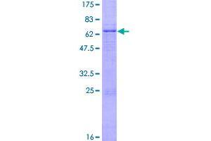 Image no. 1 for Growth Differentiation Factor 3 (GDF3) (AA 1-364) protein (GST tag) (ABIN1354969) (GDF3 Protein (AA 1-364) (GST tag))
