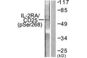 Western blot analysis of extracts from LOVO cells, using IL-2R alpha/CD25 (Phospho-Ser268) Antibody. (CD25 antibody  (pSer268))