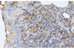 Immunohistochemistry of paraffin-embedded Rat lung using STK24 Polyclonal Antibody at dilution of 1:100 (40x lens). (STK24 antibody)