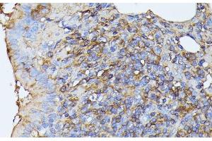 Immunohistochemistry of paraffin-embedded Rat lung using STK24 Polyclonal Antibody at dilution of 1:100 (40x lens).
