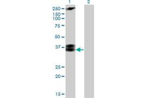 Western Blot analysis of CACNG3 expression in transfected 293T cell line by CACNG3 monoclonal antibody (M01), clone 3E4. (CACNG3 antibody  (AA 199-297))
