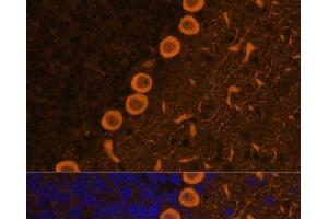 Immunofluorescence analysis of Rat brain cells using PRKCG Polyclonal Antibody at dilution of 1:100. (PKC gamma antibody)