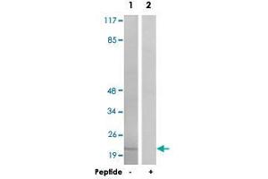 Western blot analysis of extracts from HT-29 cells, using PPP1R14A polyclonal antibody .