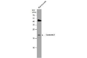Western Blotting (WB) image for anti-Caveolin 2 (CAV2) (N-Term) antibody (ABIN2856589)