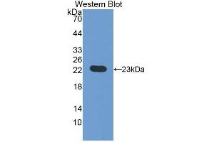 Detection of Recombinant vHL, Rat using Polyclonal Antibody to Von Hippel Lindau Tumor Suppressor (vHL) (VHL antibody  (AA 6-175))