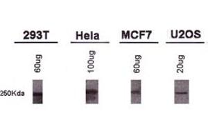 Western blot analysis of BRCA1 using BRCA1 monoclonal antibody, clone KEN . (BRCA1 antibody  (AA 1314-1864))