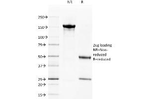 SDS-PAGE Analysis Purified CD40 Mouse Monoclonal Antibody (C40/1605). (CD40 antibody)
