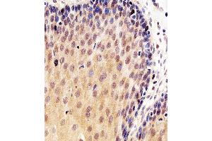 Immunohistochemical analysis of paraffin-embedded H. (p53 antibody  (AA 364-393))