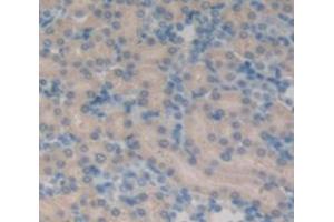 Figure. (Resistin antibody  (AA 45-114))