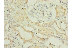 Immunohistochemistry of paraffin-embedded human kidney tissue using ABIN7152421 at dilution of 1:100 (FBXO28 antibody  (AA 251-368))