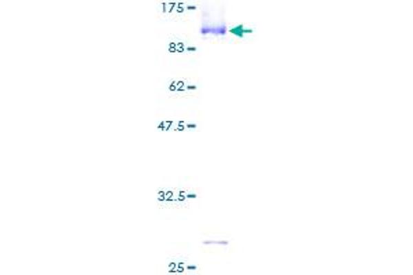 CBFA2T2 Protein (AA 1-614) (GST tag)