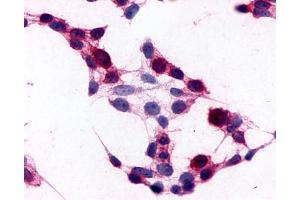 Anti-CD97 antibody immunocytochemistry (ICC) staining of HEK293 human embryonic kidney cells transfected with CD97. (CD97 antibody  (N-Term))