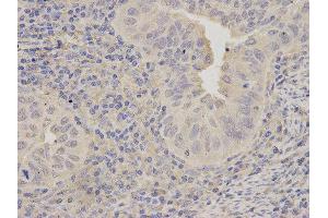 Immunohistochemistry (IHC) image for anti-Lipopolysaccharide-Induced Tumor Necrosis Factor-alpha Factor (LITAF) antibody (ABIN1876657) (LITAF antibody)