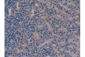 IHC-P analysis of Mouse Kidney Tissue, with DAB staining. (Versican antibody  (AA 3058-3299))