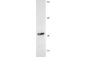 Western Blotting (WB) image for anti-Myelin Protein Zero (MPZ) antibody (ABIN953494) (MPZ antibody)
