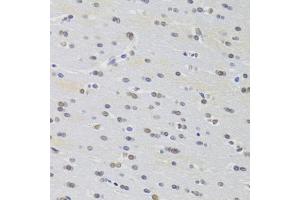 Immunohistochemistry of paraffin-embedded rat brain using PRPF3 Antibody (ABIN5973192) at dilution of 1/100 (40x lens). (PRPF3 antibody)