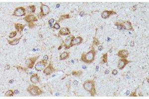 Immunohistochemistry of paraffin-embedded Rat brain using TBCB Polyclonal Antibody at dilution of 1:100 (40x lens). (TBCB antibody)
