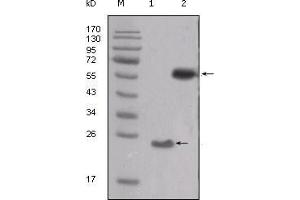 Western Blot showing SRC antibody used against truncated SRC-His recombinant protein (1) and PMA treated THP-1 cell lysate (2). (Src antibody  (AA 10-193))