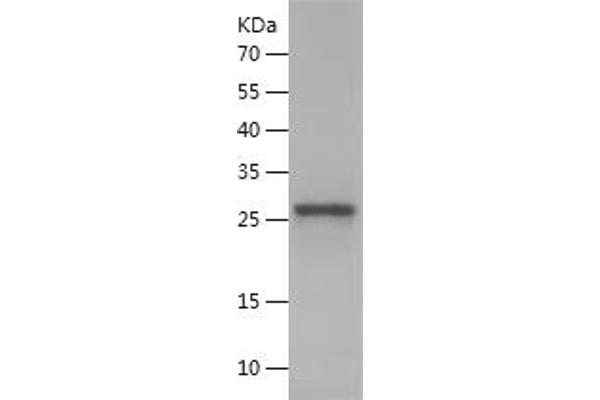 RPGR Protein (AA 19-242) (His tag)