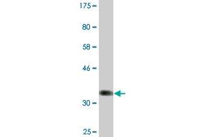 Western Blot detection against Immunogen (36. (NDOR1 antibody  (AA 498-595))