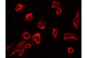 ABIN6272421 staining RAW264. (RSU1 antibody  (C-Term))