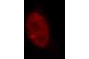 Immunofluorescence (IF) image for anti-Lysine (K)-Specific Demethylase 5A (KDM5A) (AA 1416-1434) antibody (ABIN3201015) (KDM5A antibody  (AA 1416-1434))
