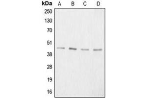 Western blot analysis of Aggrecan expression in HeLa colchicine-treated (A), mouse kidney (B), PC12 colchicine-treated (C), NIH3T3 (D) whole cell lysates.