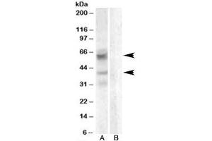 Western blot testing of A459 lysate with Arylsulfatase D antibody with [B] and without [A] blocking/immunizing peptide. (Arylsulfatase D antibody)