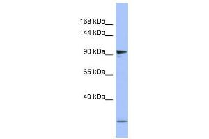 PSMD1 antibody used at 1 ug/ml to detect target protein. (PSMD1 antibody)