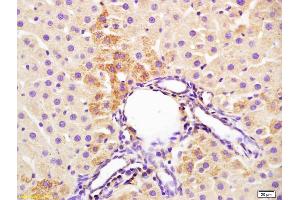 Formalin-fixed and paraffin embedded rat liver labeled with Anti-IL-3 Polyclonal Antibody, Unconjugated (ABIN747788) at 1:200 followed by conjugation to the secondary antibody and DAB staining (IL-3 antibody  (AA 101-166))