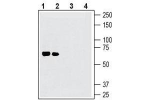 Western Blotting (WB) image for anti-Netrin 1 (NTN1) (AA 181-195), (Secreted) antibody (ABIN7043349)