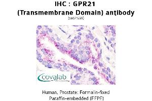 Image no. 1 for anti-G Protein-Coupled Receptor 21 (GPR21) antibody (ABIN1735029)