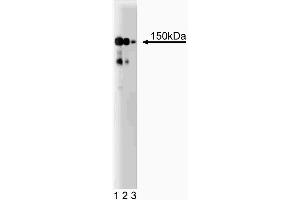 Western blot analysis of CD49b (Integrin alpha2) on a HeLa cell lysate (Human cervical epitheloid carcinoma, ATCC CCL-2. (ITGA2 antibody  (AA 42-245))