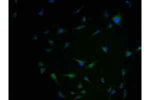 Kir2.2 antibody  (AA 182-433)