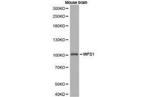 Western Blotting (WB) image for anti-Wolfram Syndrome 1 (WFS1) antibody (ABIN1875347) (WFS1 antibody)