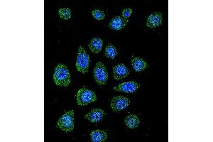 Confocal immunofluorescent analysis of BPN1L Antibody (Center) (ABIN655857 and ABIN2845264) with A549 cell followed by Alexa Fluor 488-conjugated goat anti-rabbit lgG (green). (PABPN1L antibody  (AA 166-194))